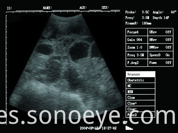 v5 pet ultrasound